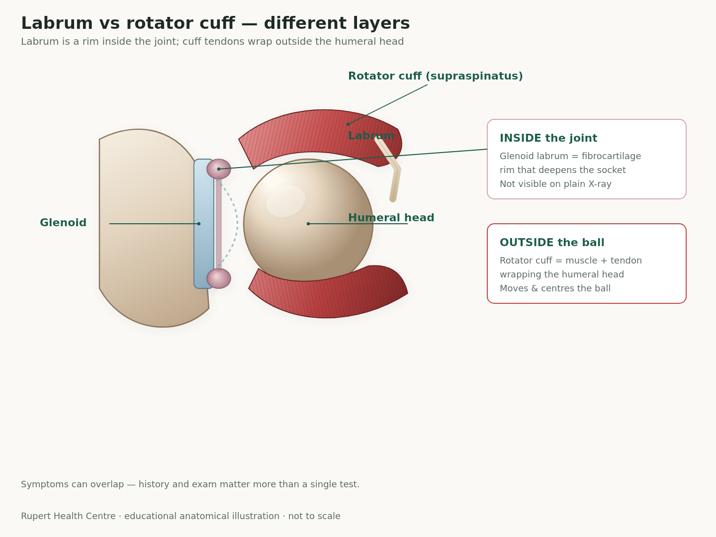 Anatomical side-view illustration contrasting the labrum as a rim inside the shoulder socket with rotator cuff tendons wrapping outside the humeral head.