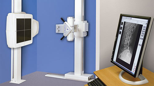 Digital X-ray