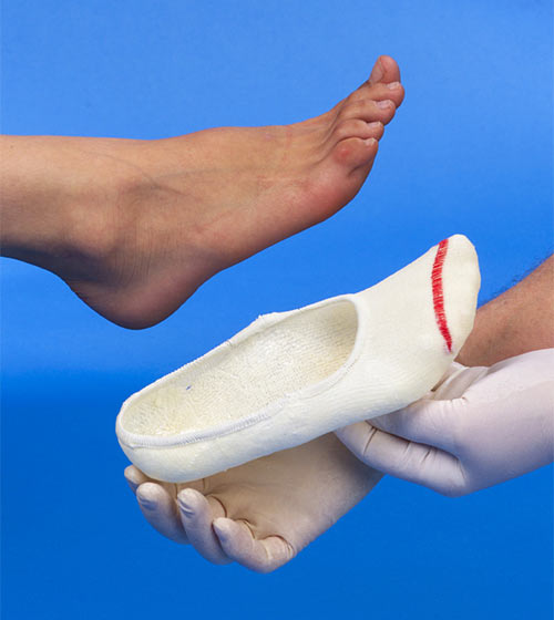 Custom Orthotics - Slipper Cast